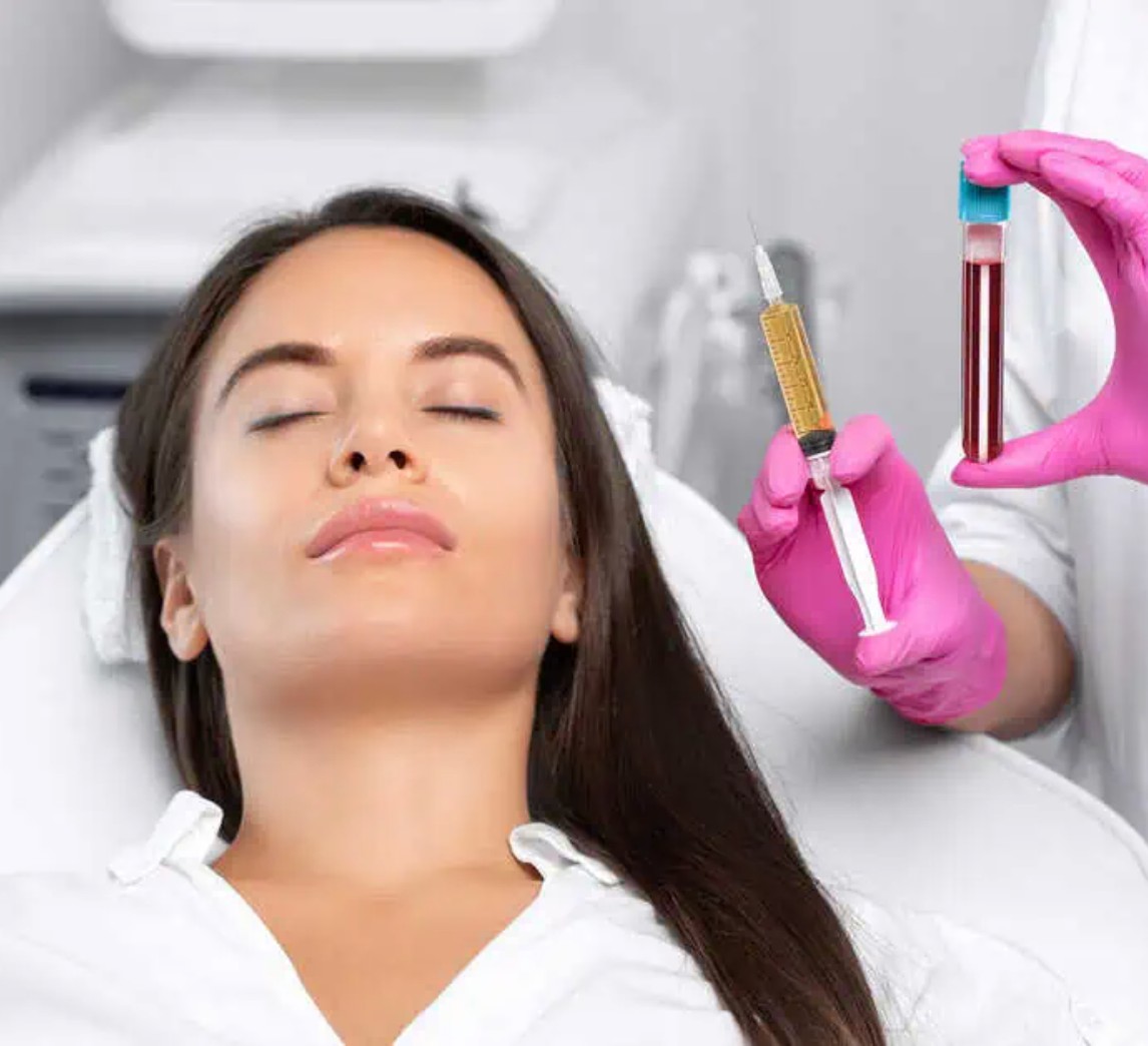 Patient receiving Platelet Rich Plasma facial treatment with Platelet Rich Plasma serum prepared for injection