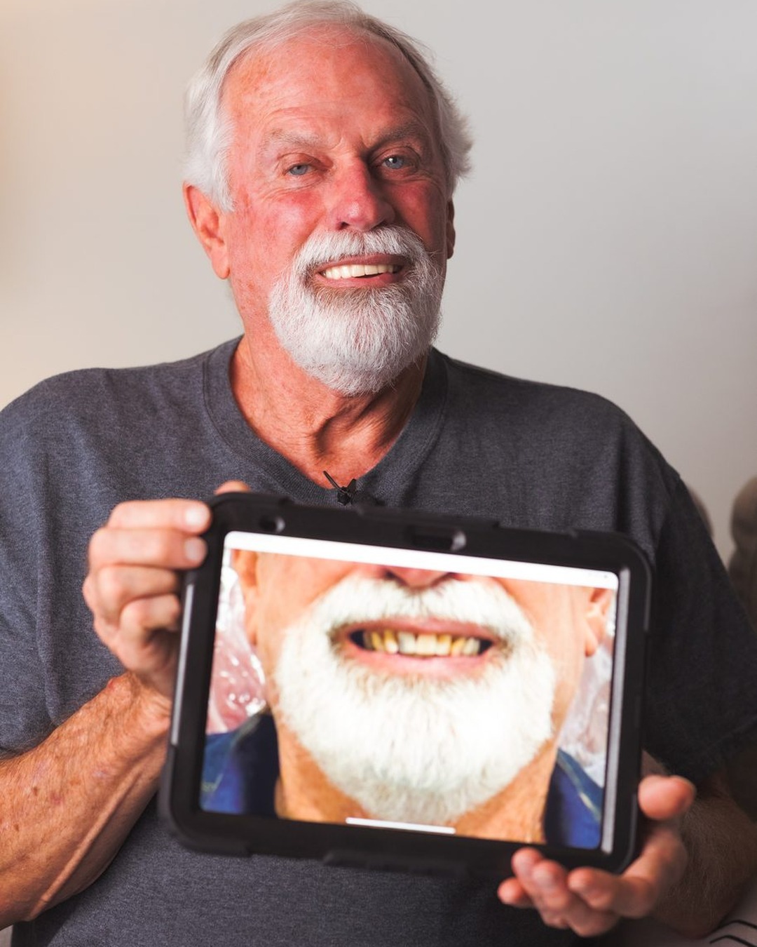 Old Betsy Dental implant patient holding a photo of his old smile