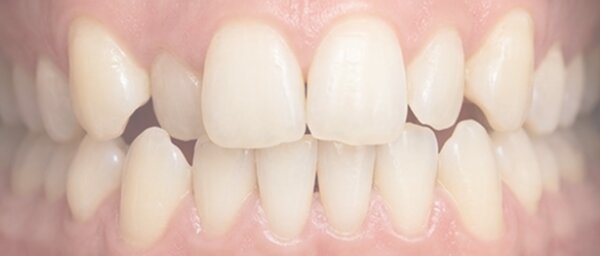 Before