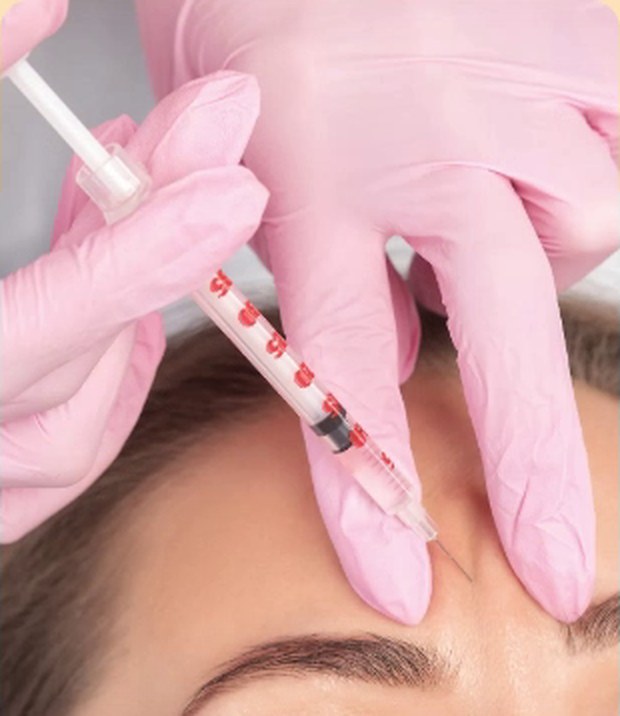 A neurotoxin injection being administered to the forehead