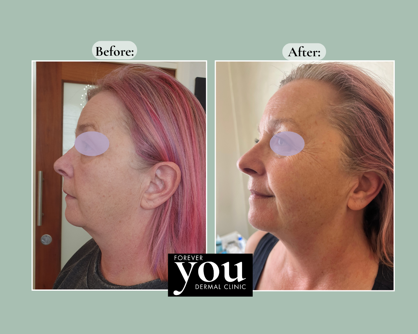 Editable before-and-after case example placeholder