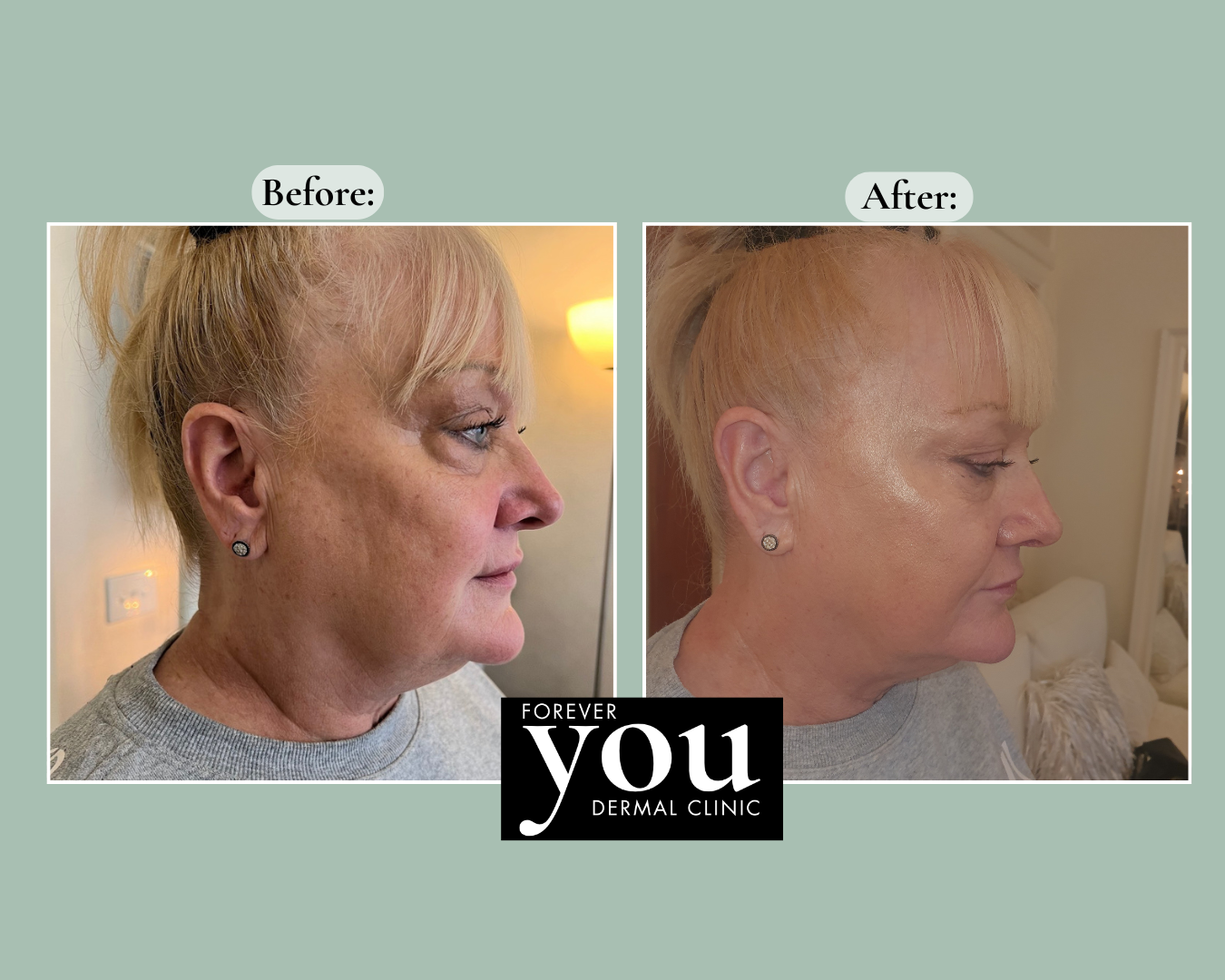 Editable before-and-after case example placeholder