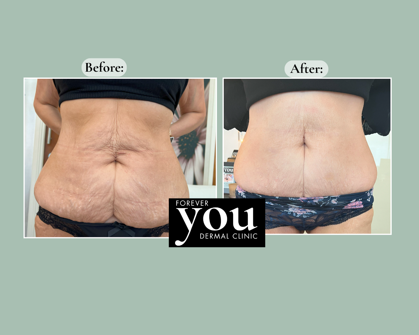 Editable before-and-after case example placeholder