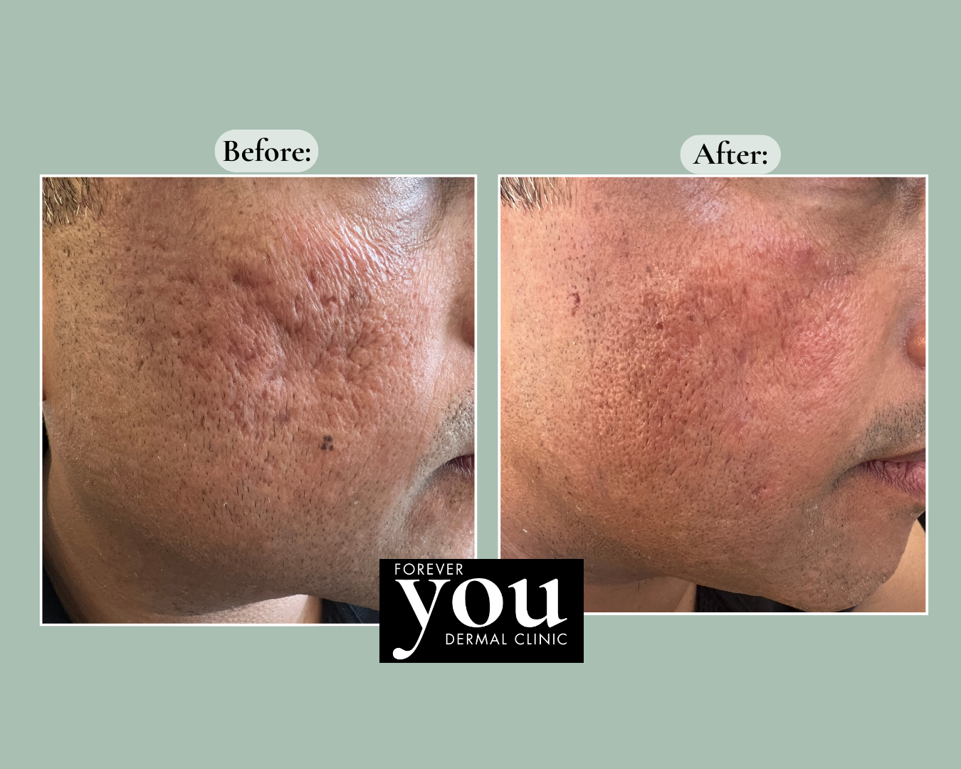 Editable before-and-after case example placeholder