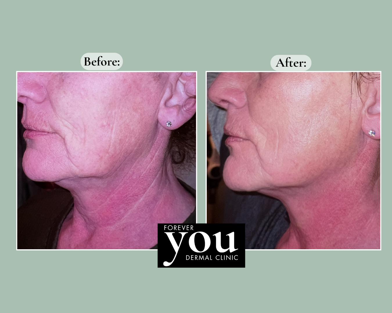 Editable before-and-after case example placeholder