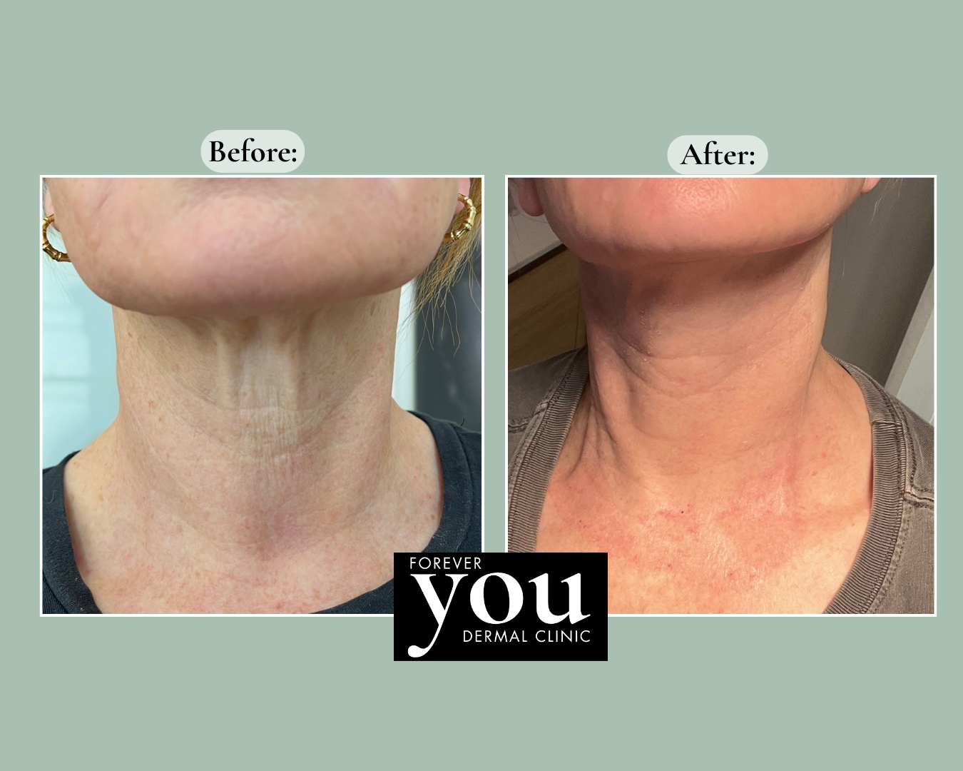 Editable before-and-after case example placeholder