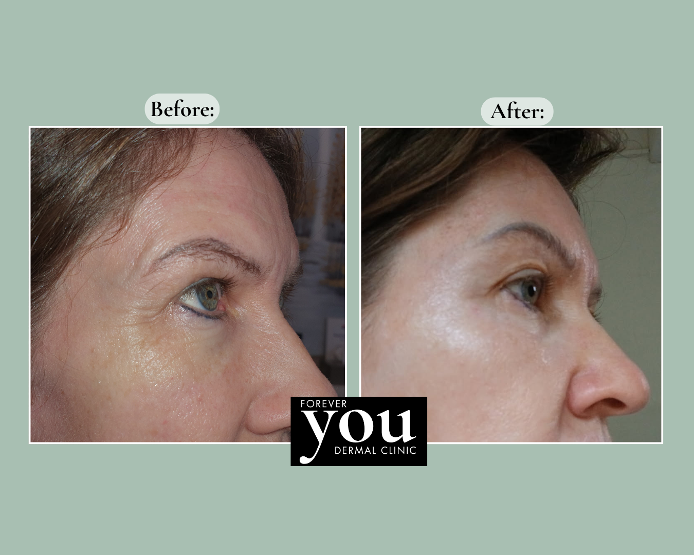 Editable before-and-after case example placeholder