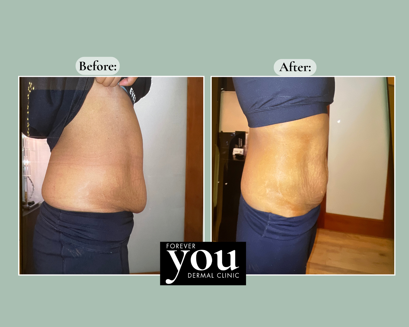 Editable before-and-after case example placeholder