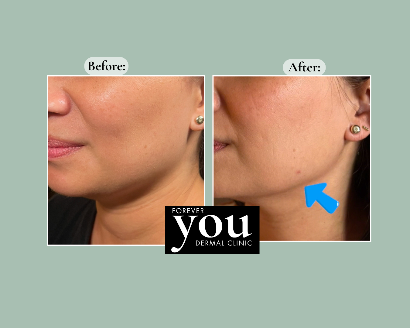 Editable before-and-after case example placeholder