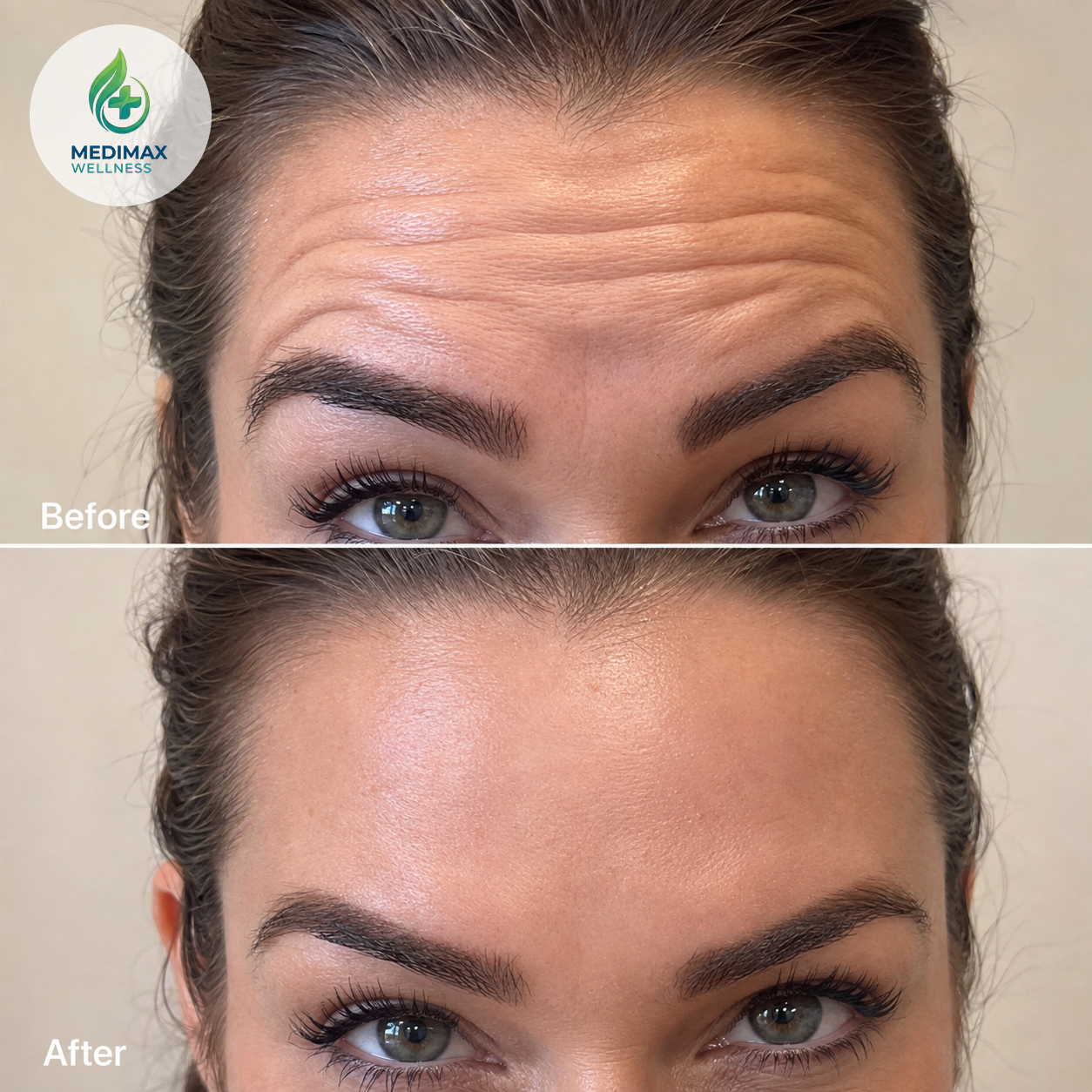 Before-and-after comparison supplied by Medimax Wellness, example 3