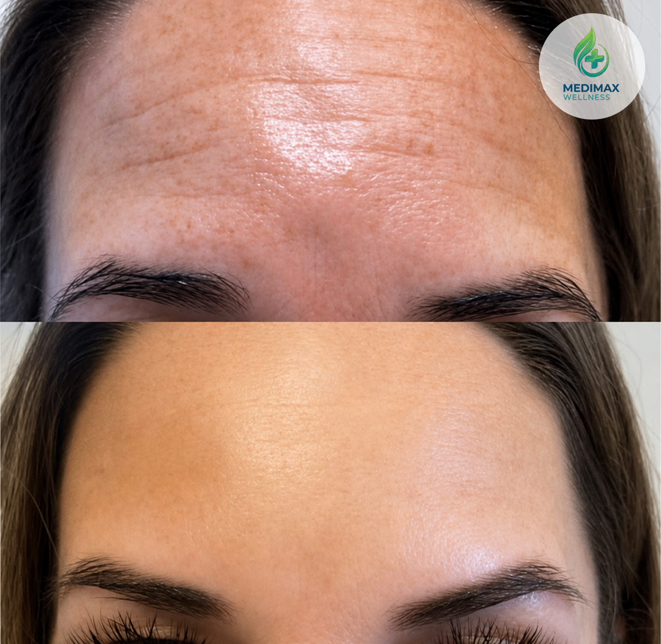 Before-and-after comparison supplied by Medimax Wellness, example 1