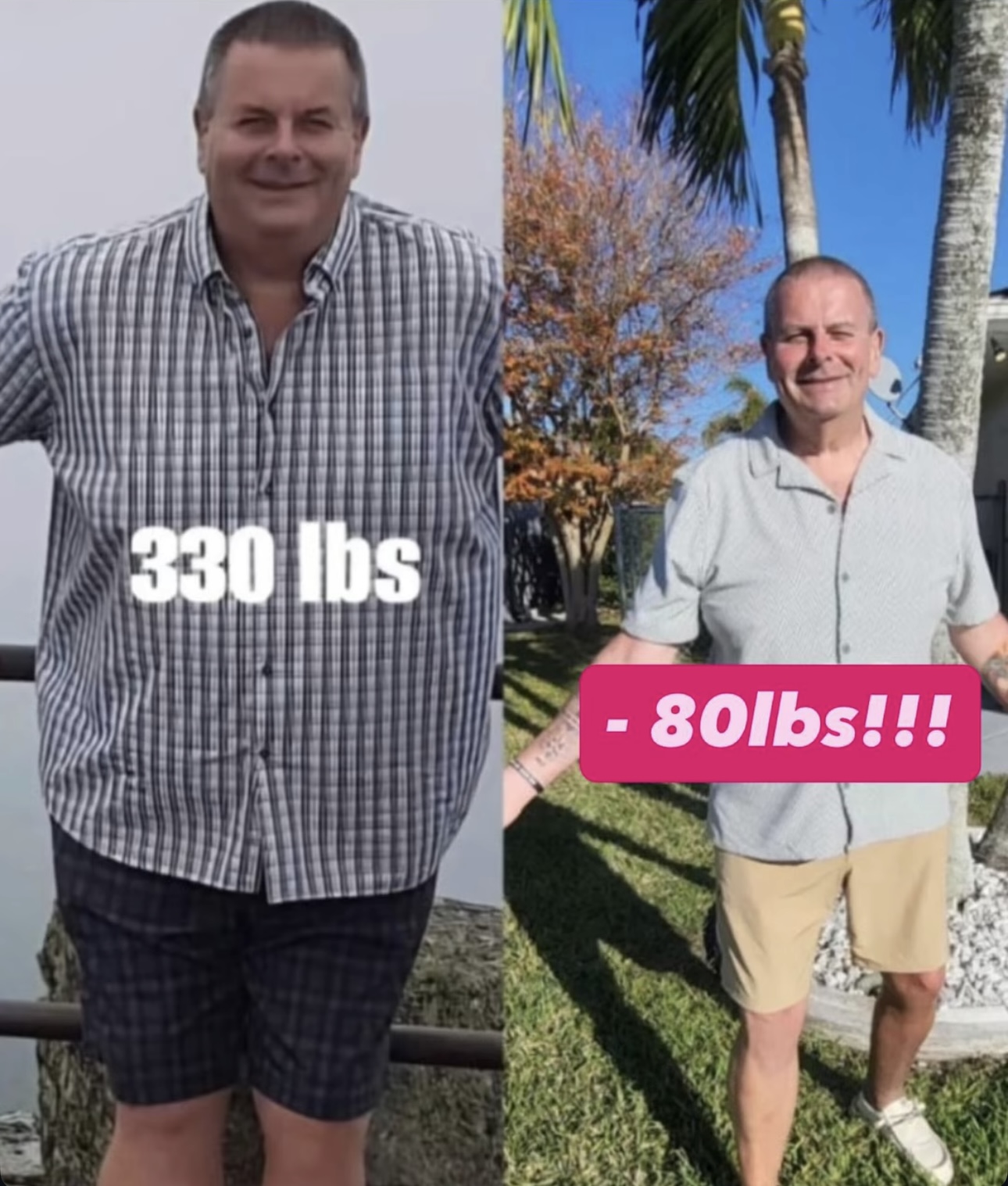 Transformation