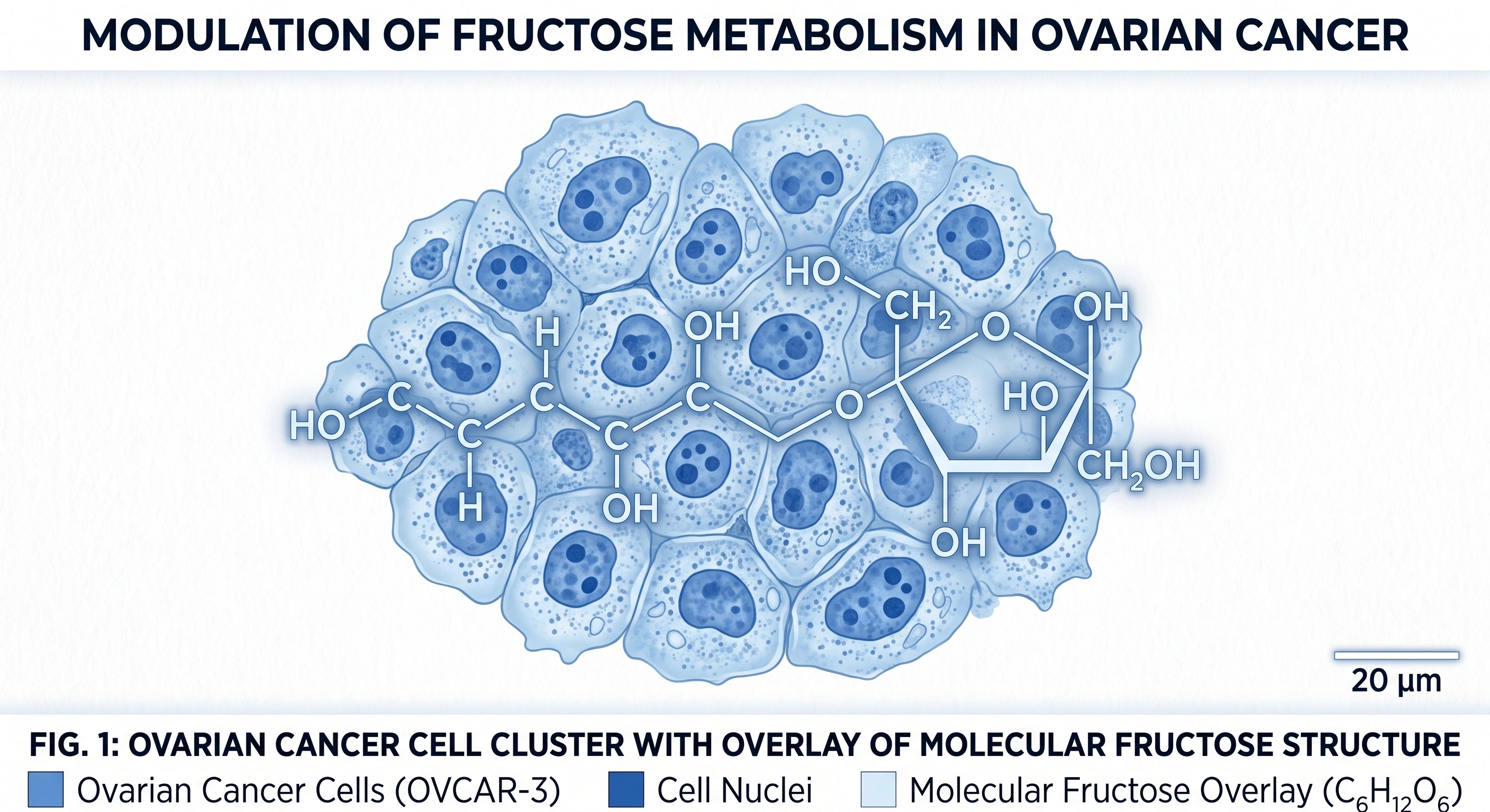Illustration of ovarian cancer cells and fructose molecule linked to cancer metastasis research. Illustration of ovarian cancer cells and fructose molecule linked to cancer metastasis research.