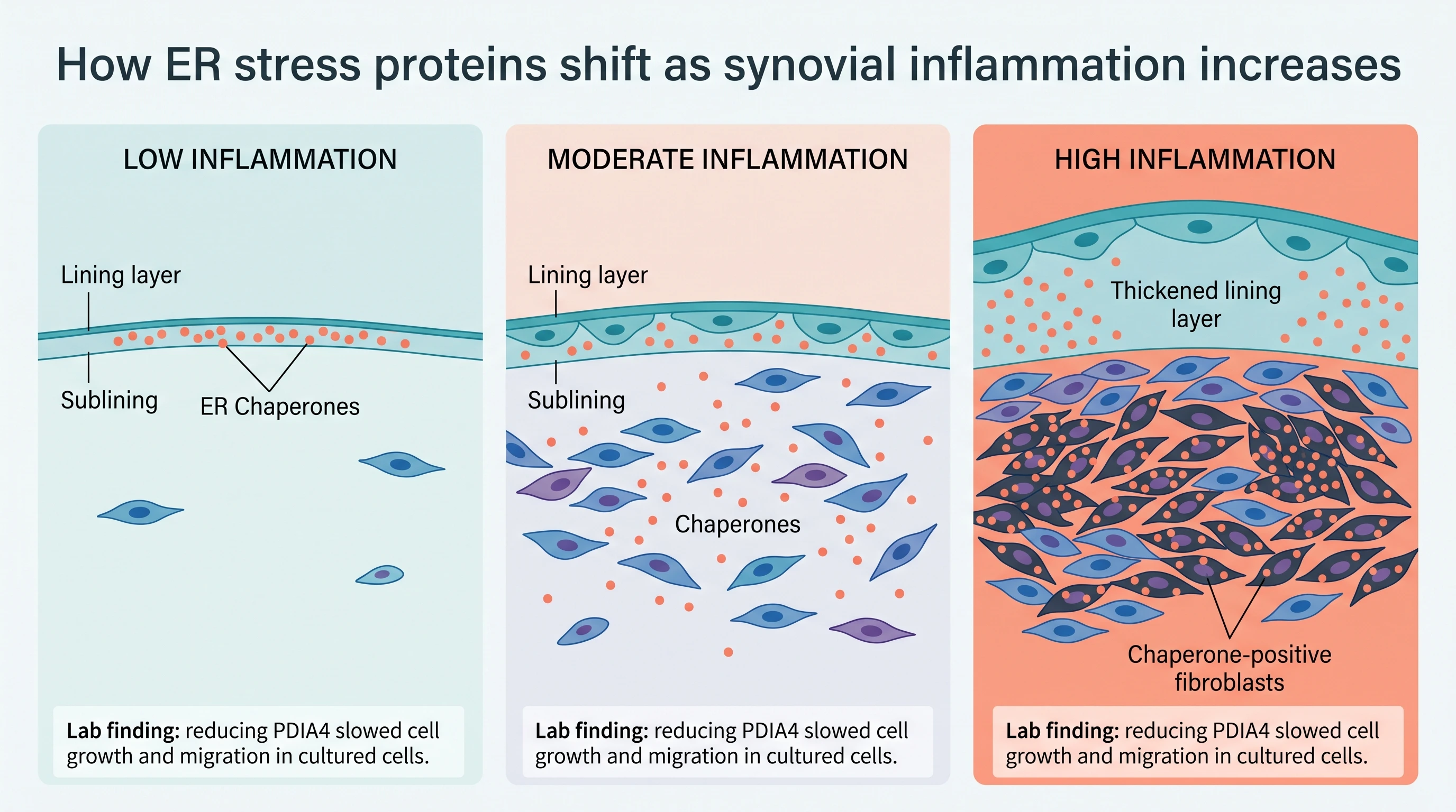 Infographic showing how ER stress proteins and joint inflammation progress from the synovial lining to the sublining in osteoarthritis Infographic showing how ER stress proteins and joint inflammation progress from the synovial lining to the sublining in osteoarthritis