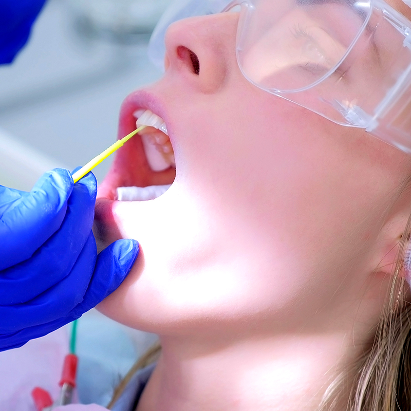 Photo of a woman with blonde hair lying back with her mouth open and bright light shining in. She has clear safety glasses on. A hand with a dark purple glove is holding a yellow probe in her mouth