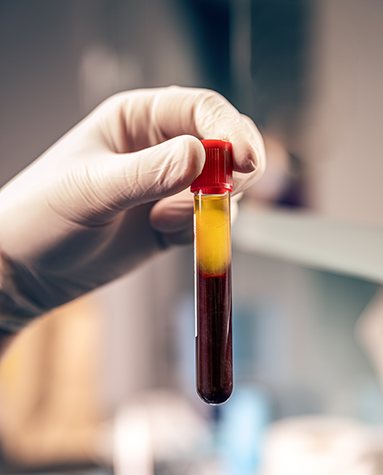 Hand in exam glove holding vial of blood with separated platelets on top