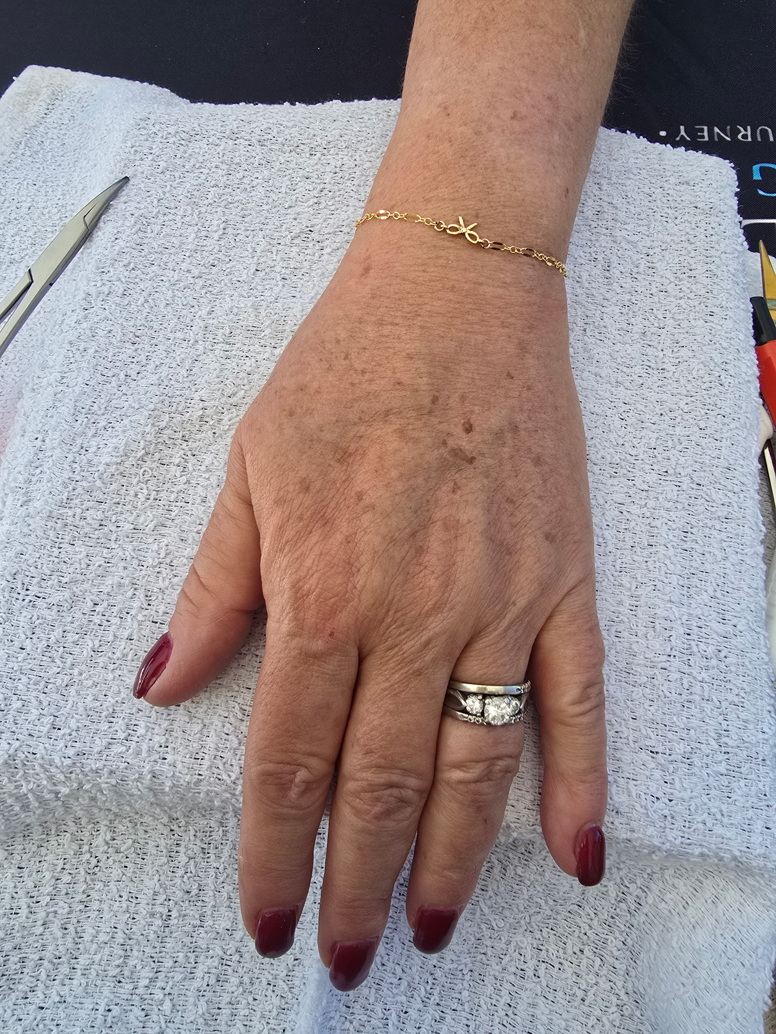 Client's gold permanent bracelet after the weld, Payson AZ
