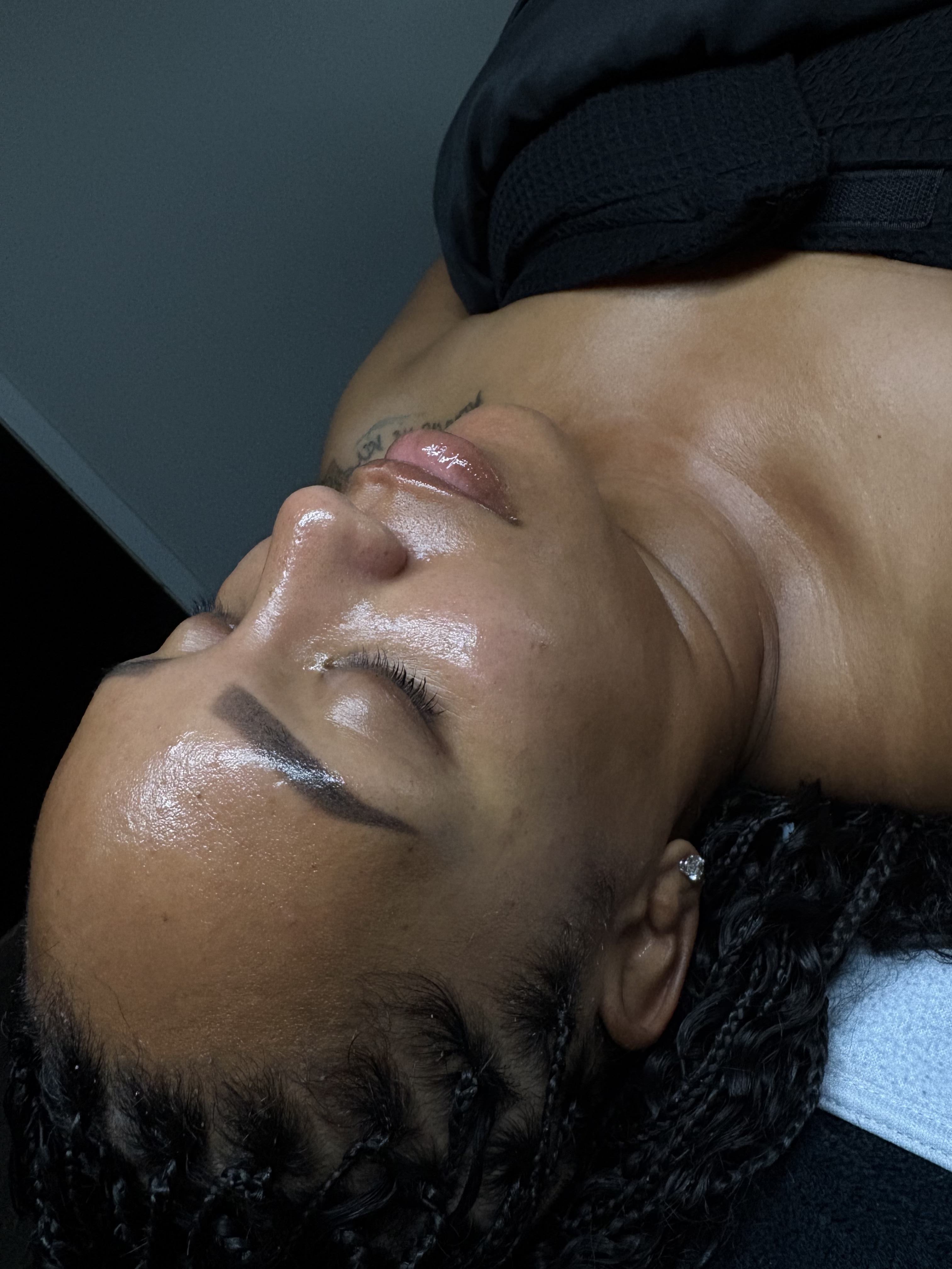 Skin Treatment Result