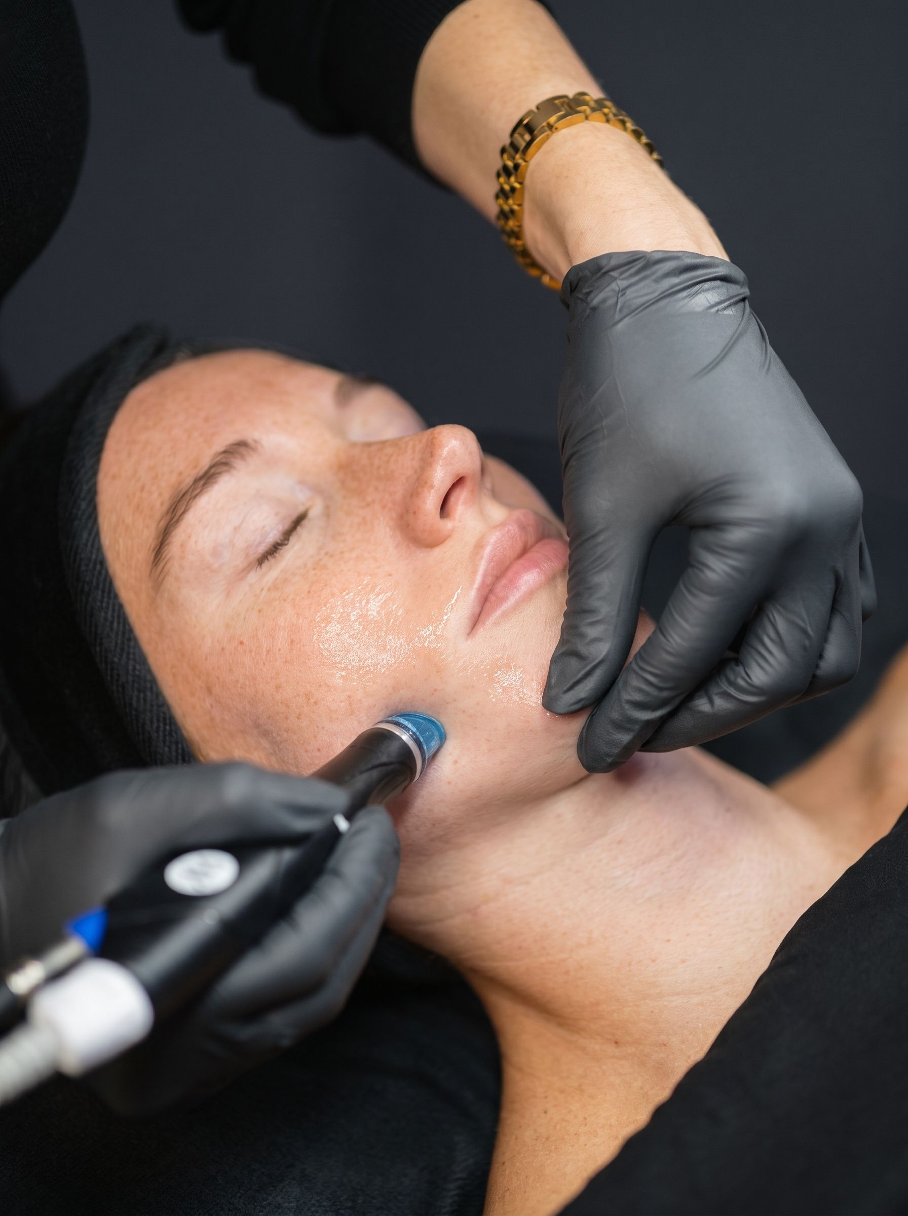 HydraFacial at Derma Excellence, Shadman, Lahore