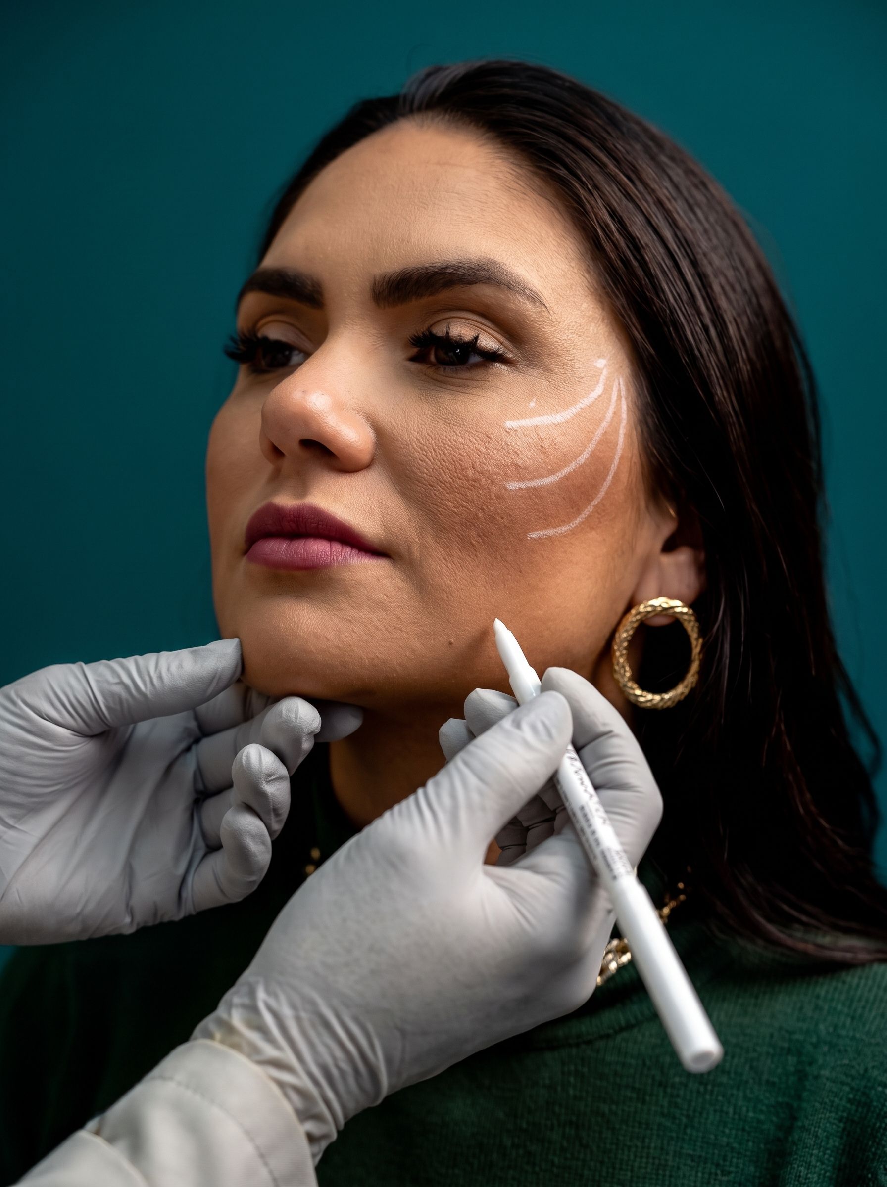 Face Threads at Derma Excellence, Shadman, Lahore