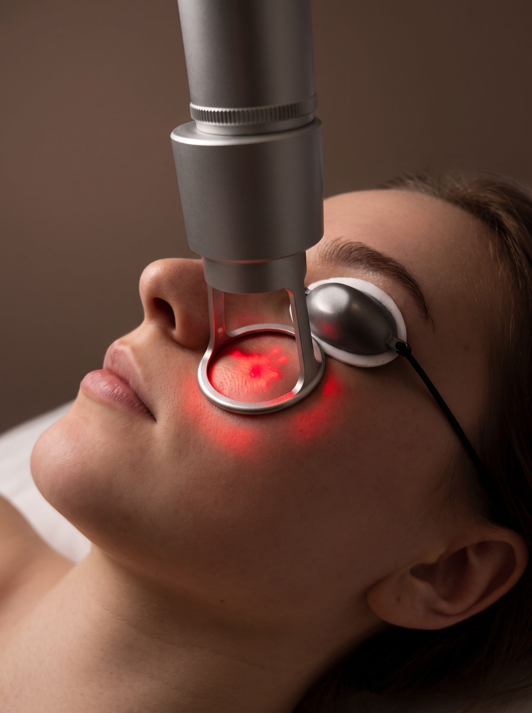 Fractional CO2 Laser at Derma Excellence, Shadman, Lahore