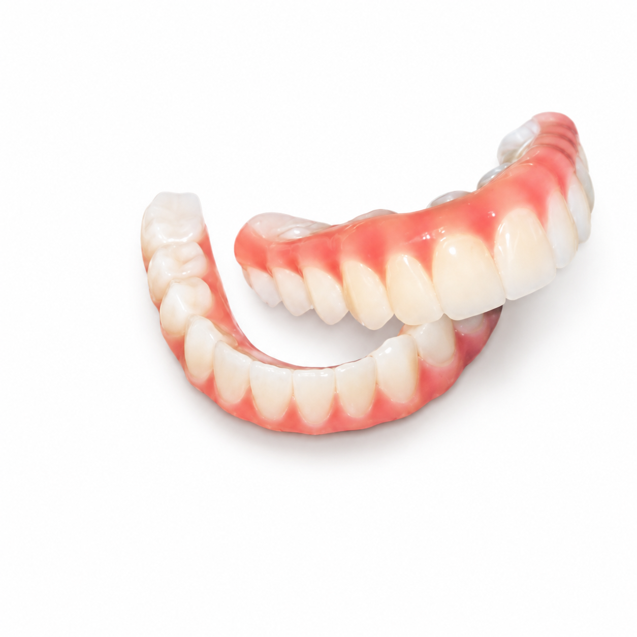 Fixed All-on-X full-arch implant bridge with an open palate