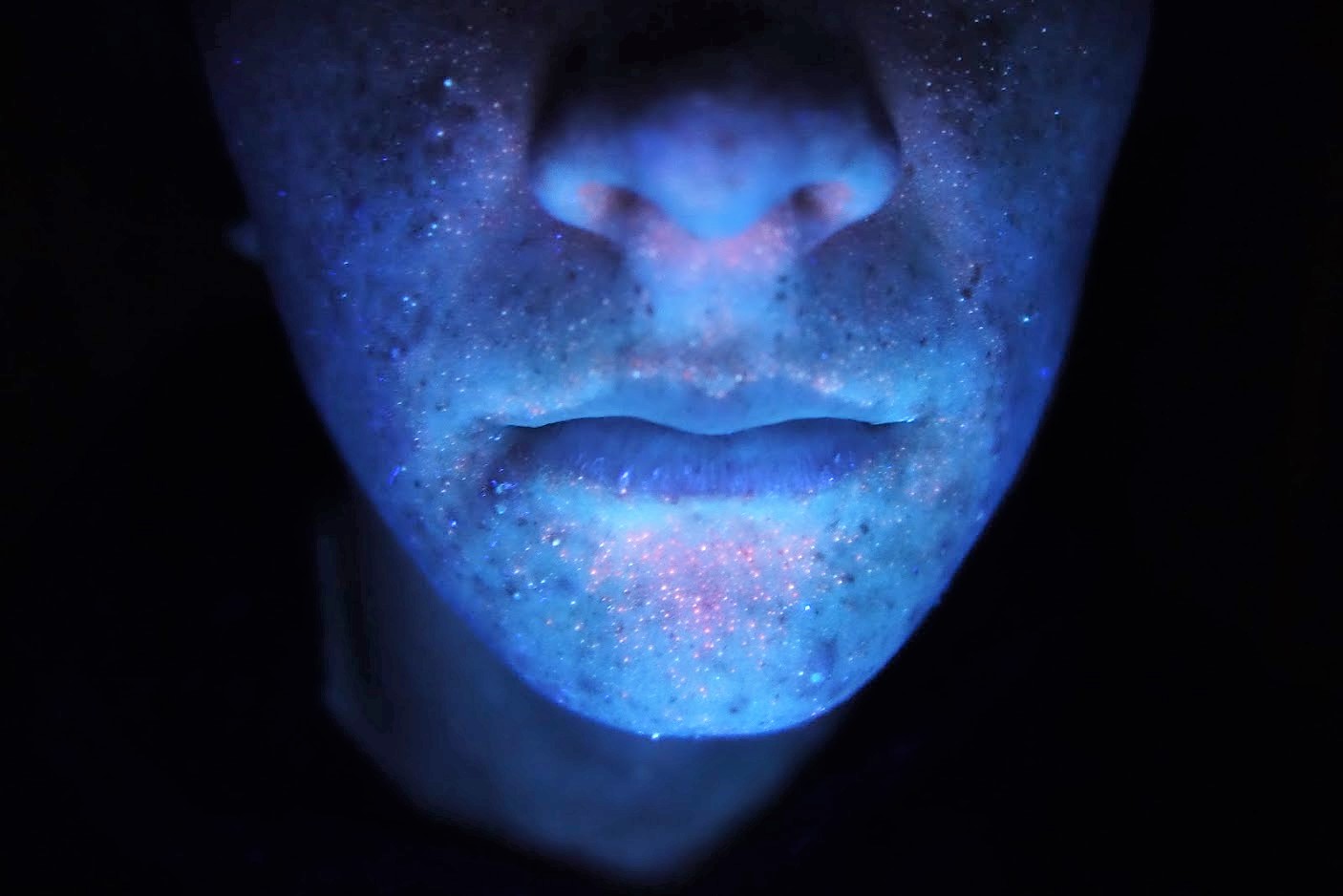 cara iluminada por luz de wood para revelar las manchas de vitiligo Lola dermonutricion piel sana cara iluminada por luz de wood para revelar las manchas de vitiligo Lola dermonutricion piel sana