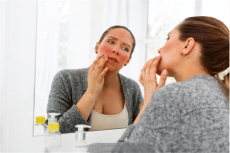 Mujer mirandose en un espejo observando la dermatitis de su rostro Mujer mirandose en un espejo observando la dermatitis de su rostro