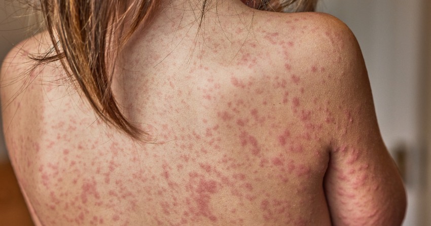 mujer mirando estante productos cosmetica lola dermonutricion piel sana dermatitis
