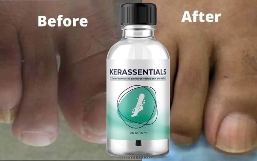 Kerassential Results