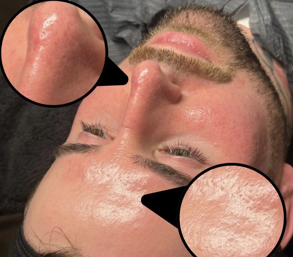 After treatment