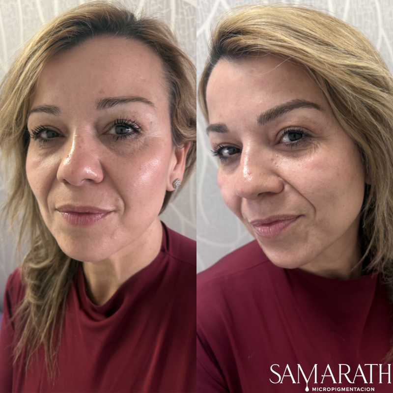 Antes y después de micropigmentación de cejas en Samarath Leganés