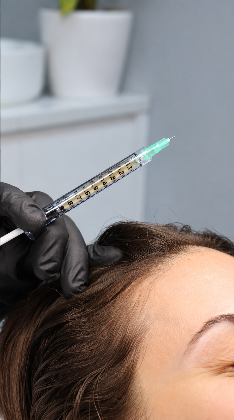 Why choose ReVita Med Clinic for PRP hair treatment