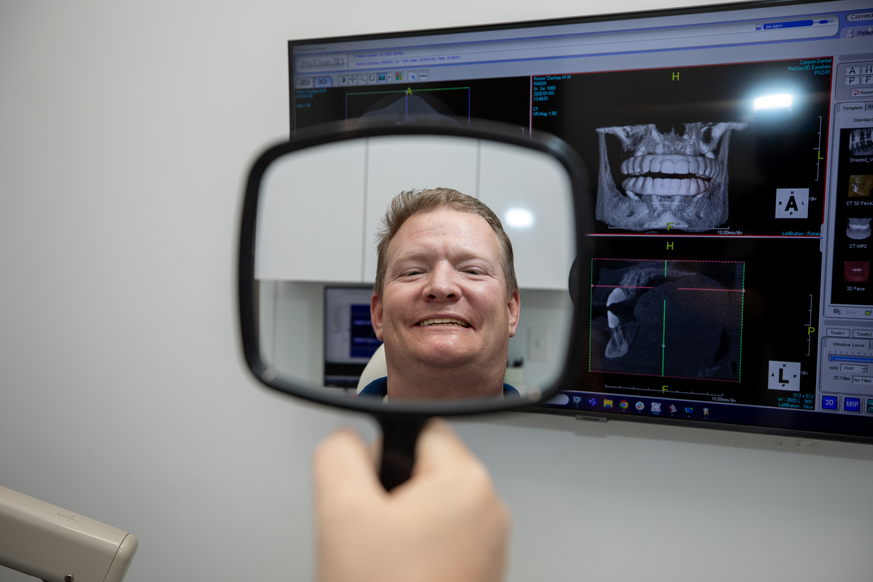 Patient smile after dental implant treatment