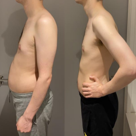 Side-by-side before-and-after client transformation, result 06.