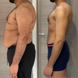 Side-by-side before-and-after client transformation, result 10.
