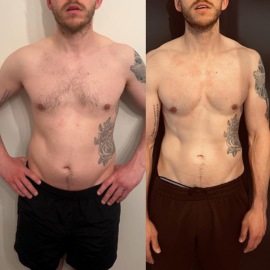 Side-by-side before-and-after client transformation, result 08.