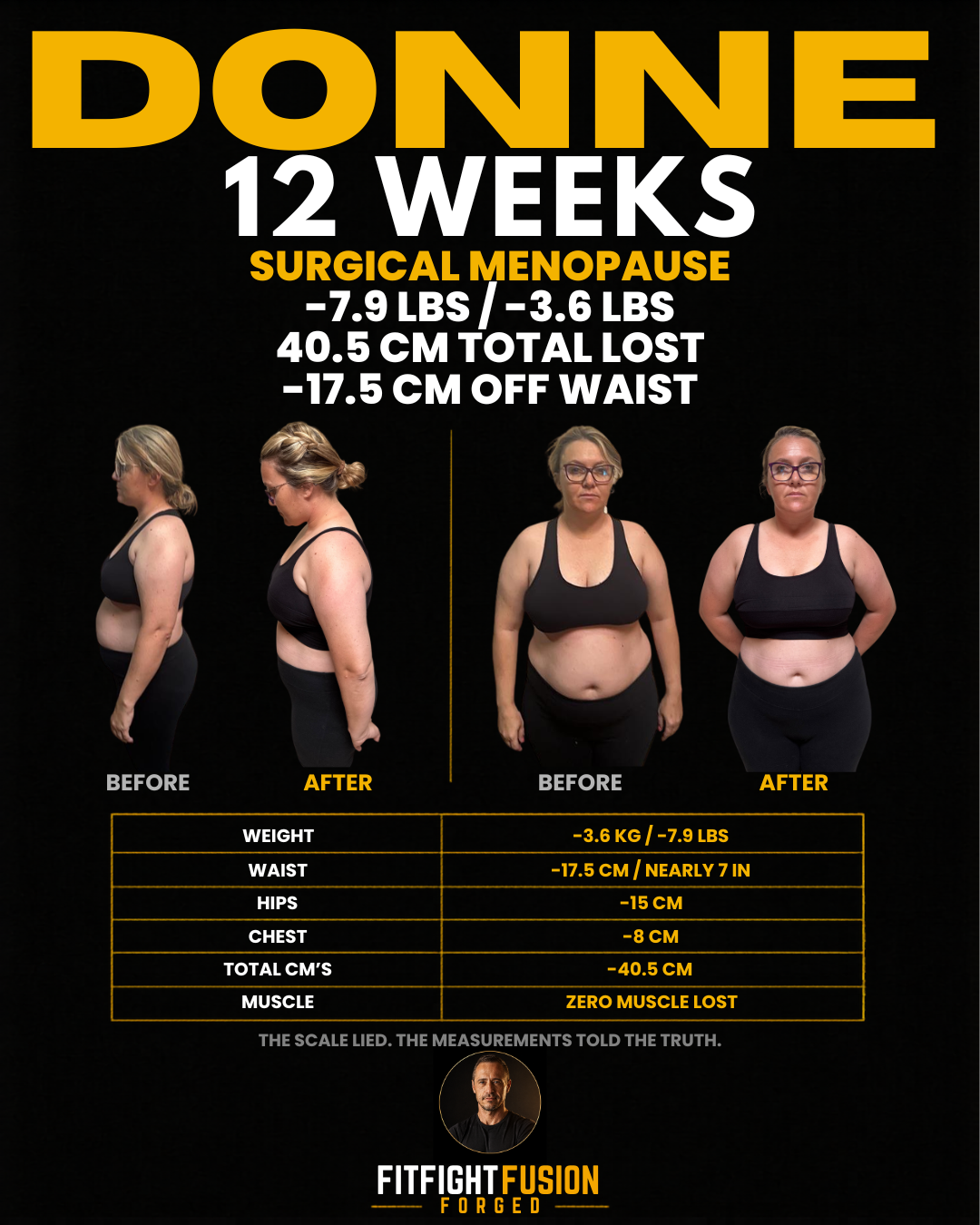 Donn√©, 12 weeks, surgical menopause