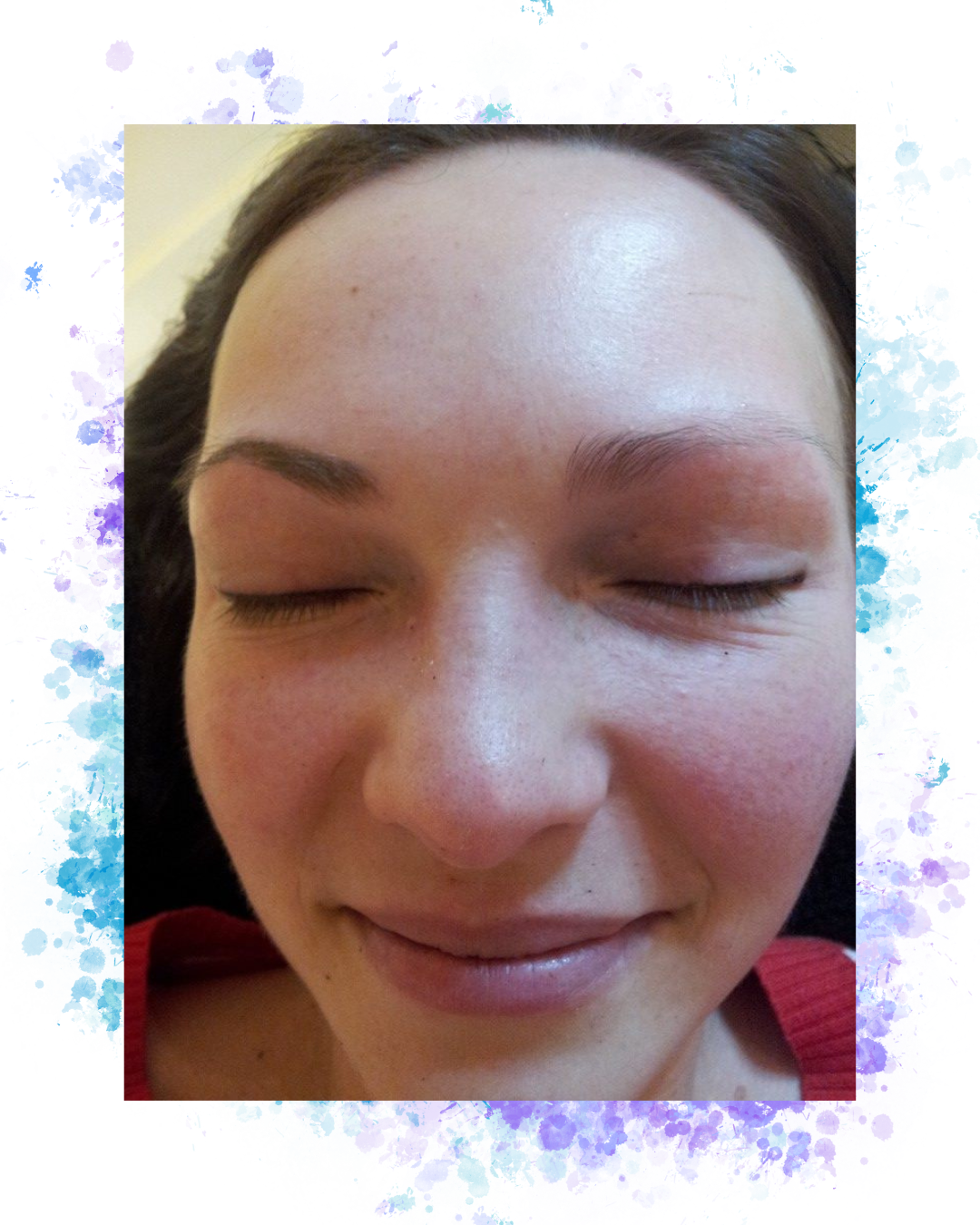 A woman enjoying a facial treatment with a high-tech machine, relaxing in a tranquil spa setting.