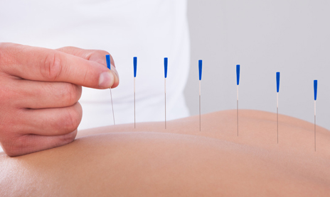 Acupuncture needle treatment for pain relief