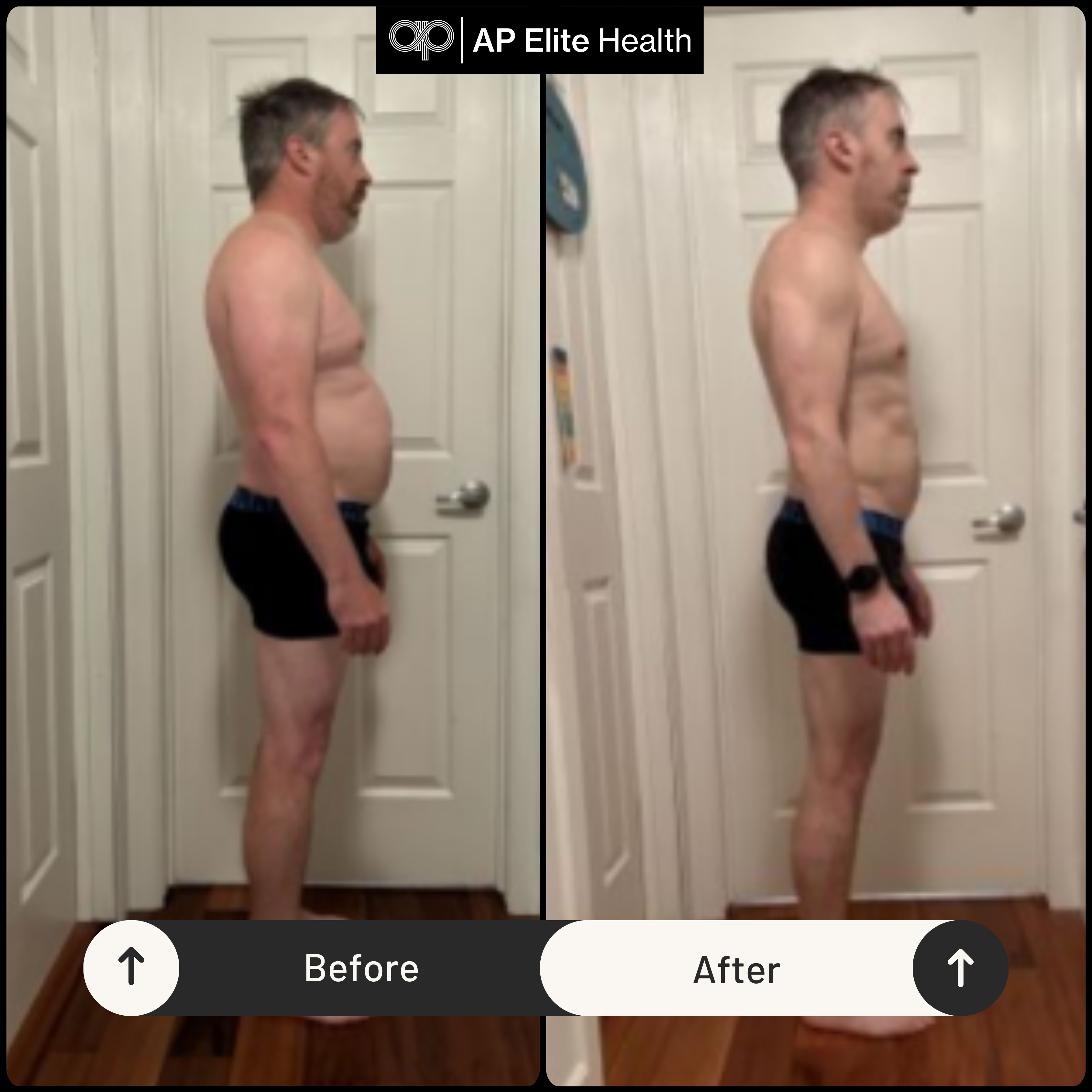 Before After