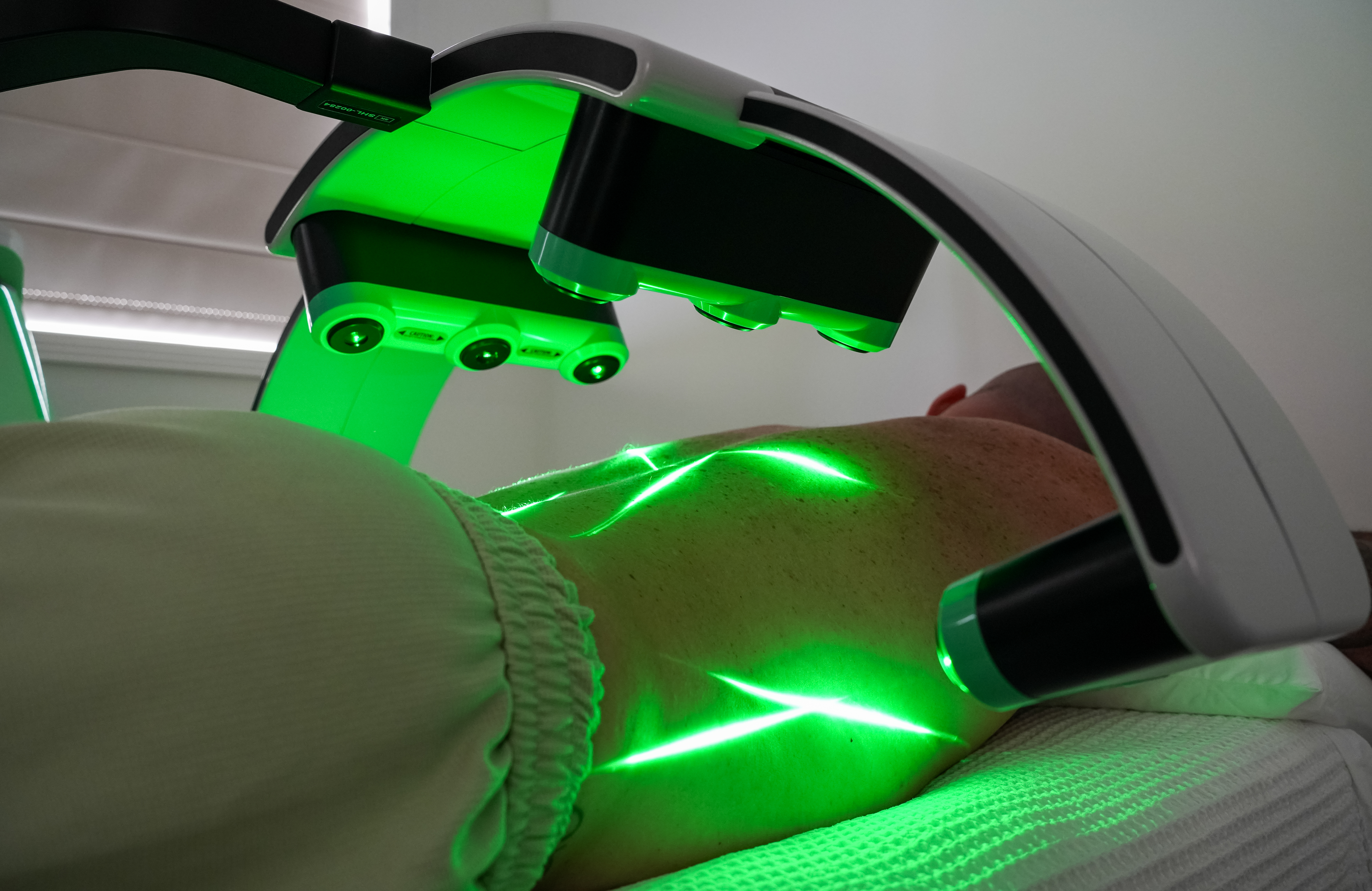 The Erchonia Emerald Laser at Envisage Clinic