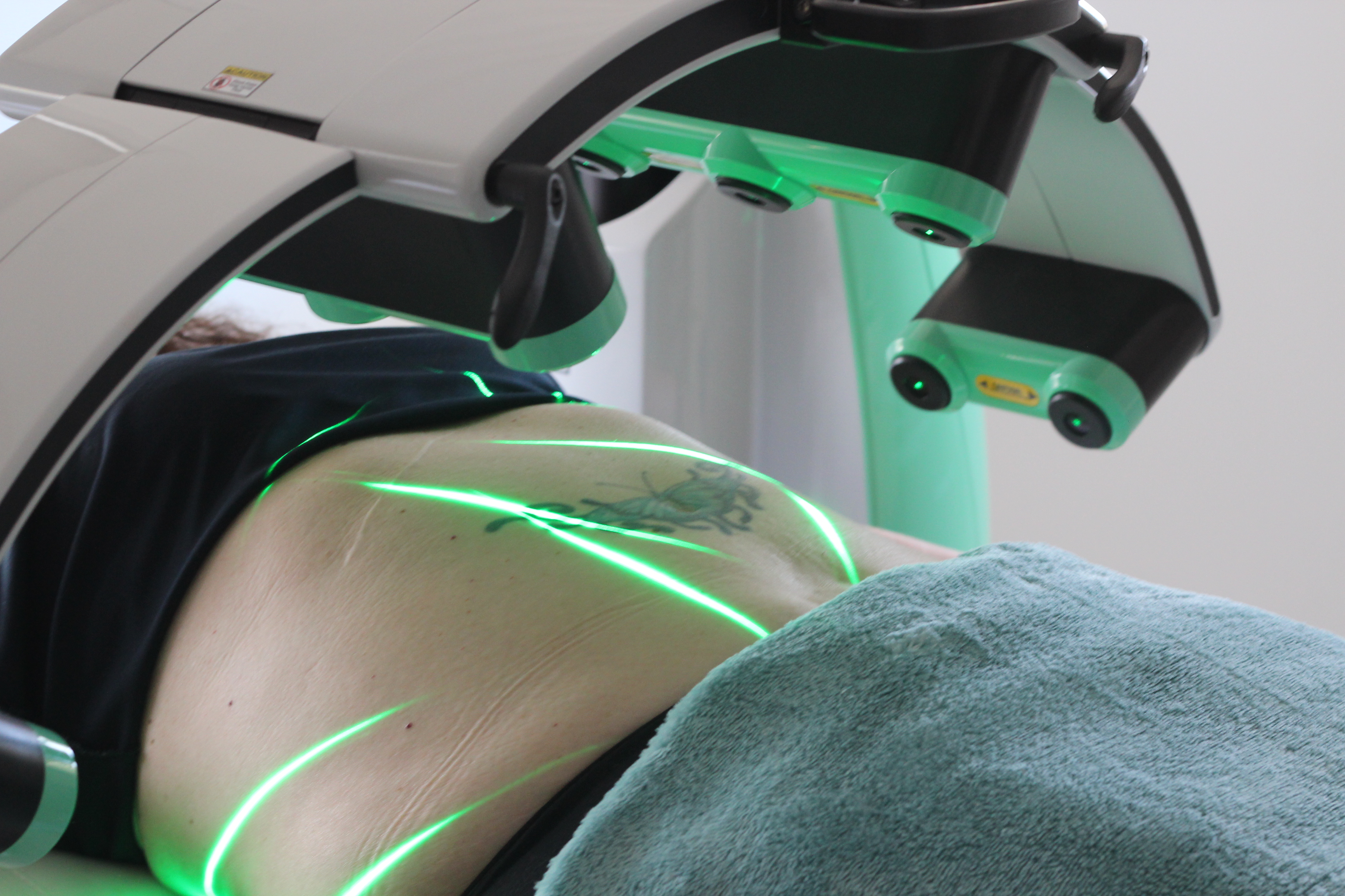 The Emerald Laser in the treatment room at Envisage Clinic
