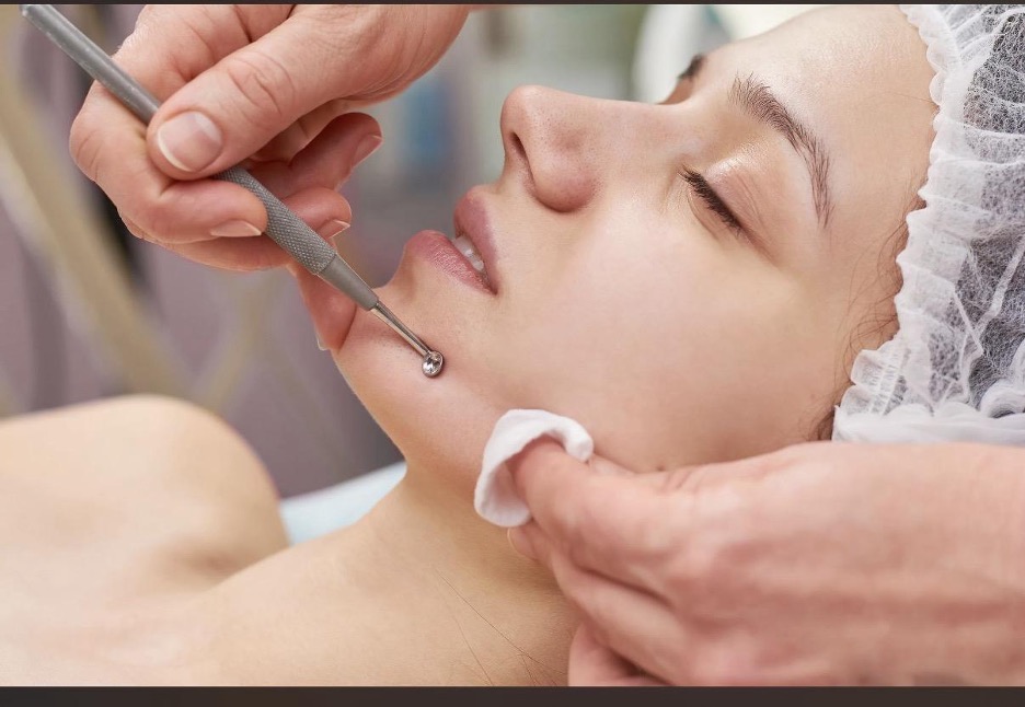 Acne Prone Skin Treatment