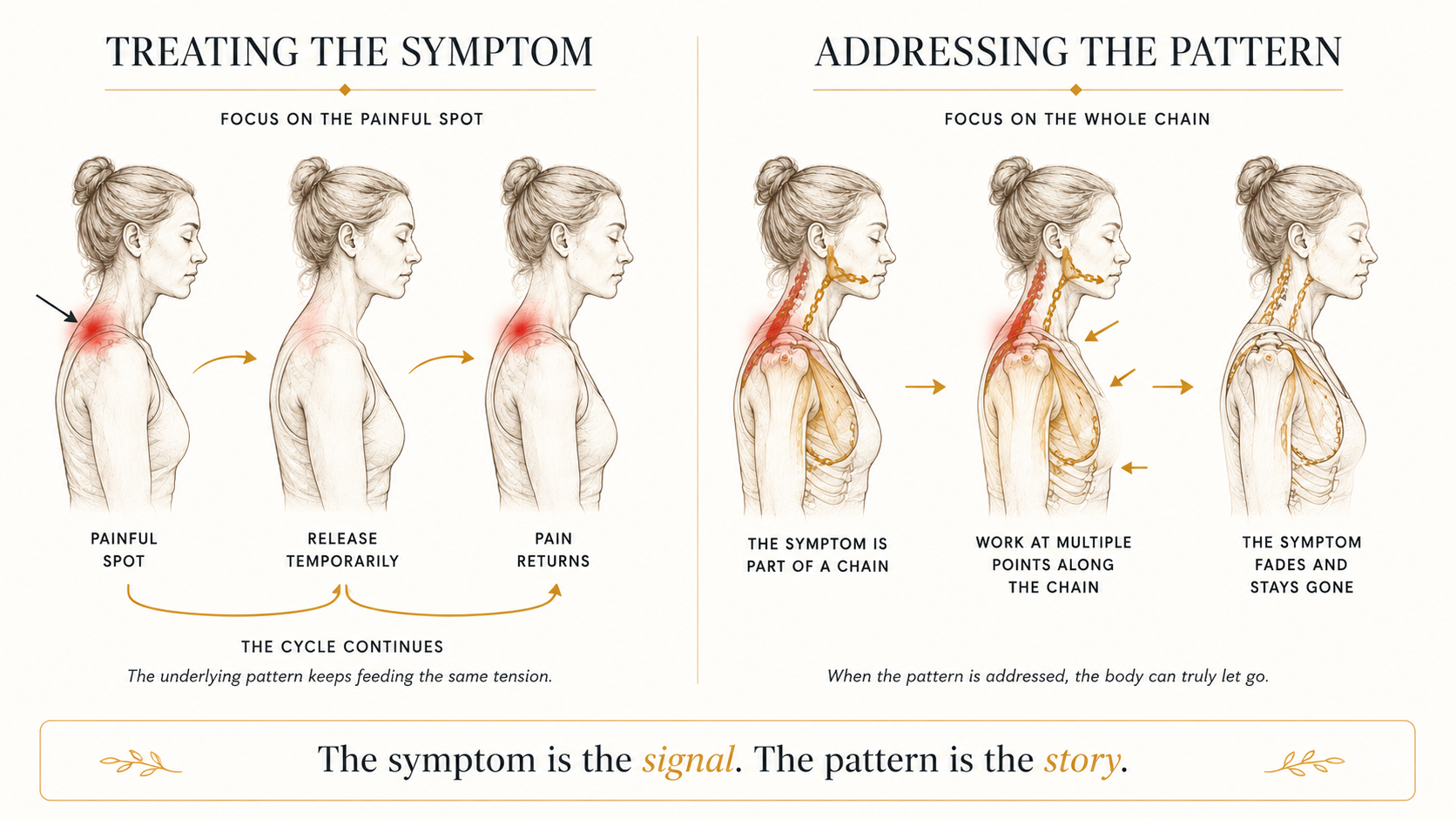Educational diagram comparing treating a painful spot versus addressing the full fascial chain — the symptom is the signal, the pattern is the story