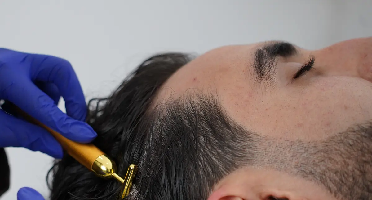 PRP hair treatment at Dermamina London