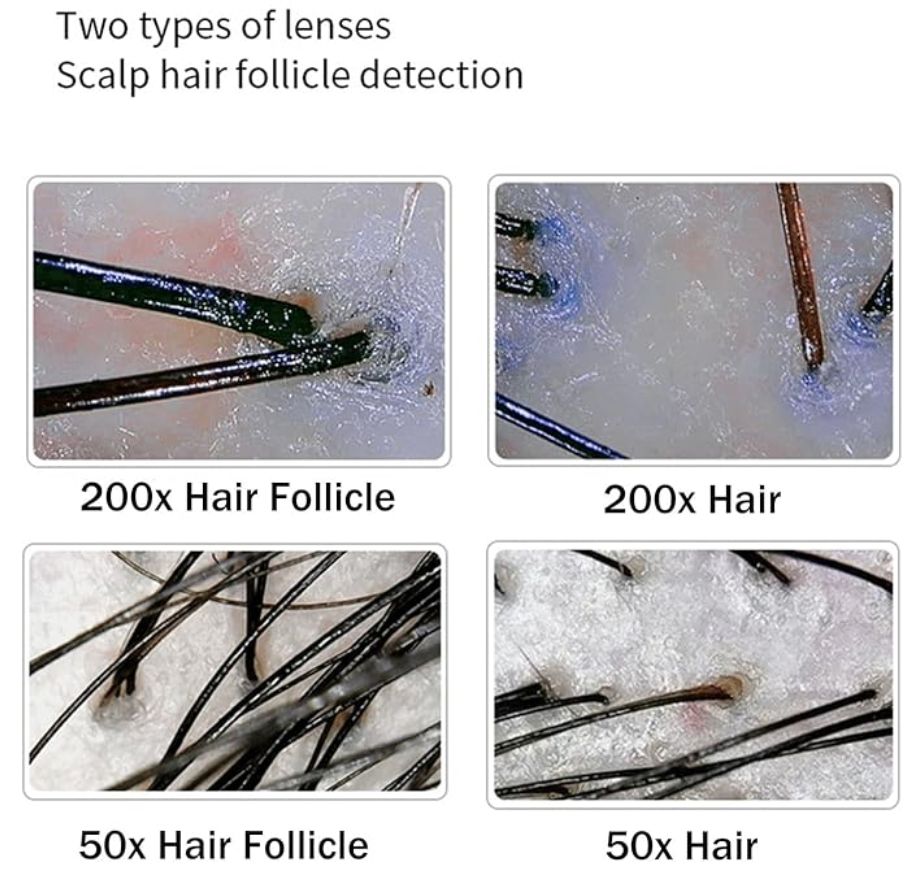 Hair viewed under tricho-analyser at Dermamina London