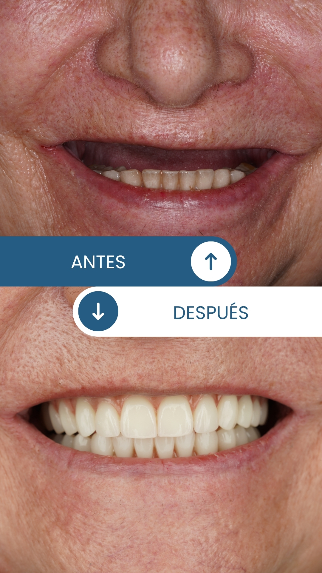 Caso real de rehabilitación oral 1
