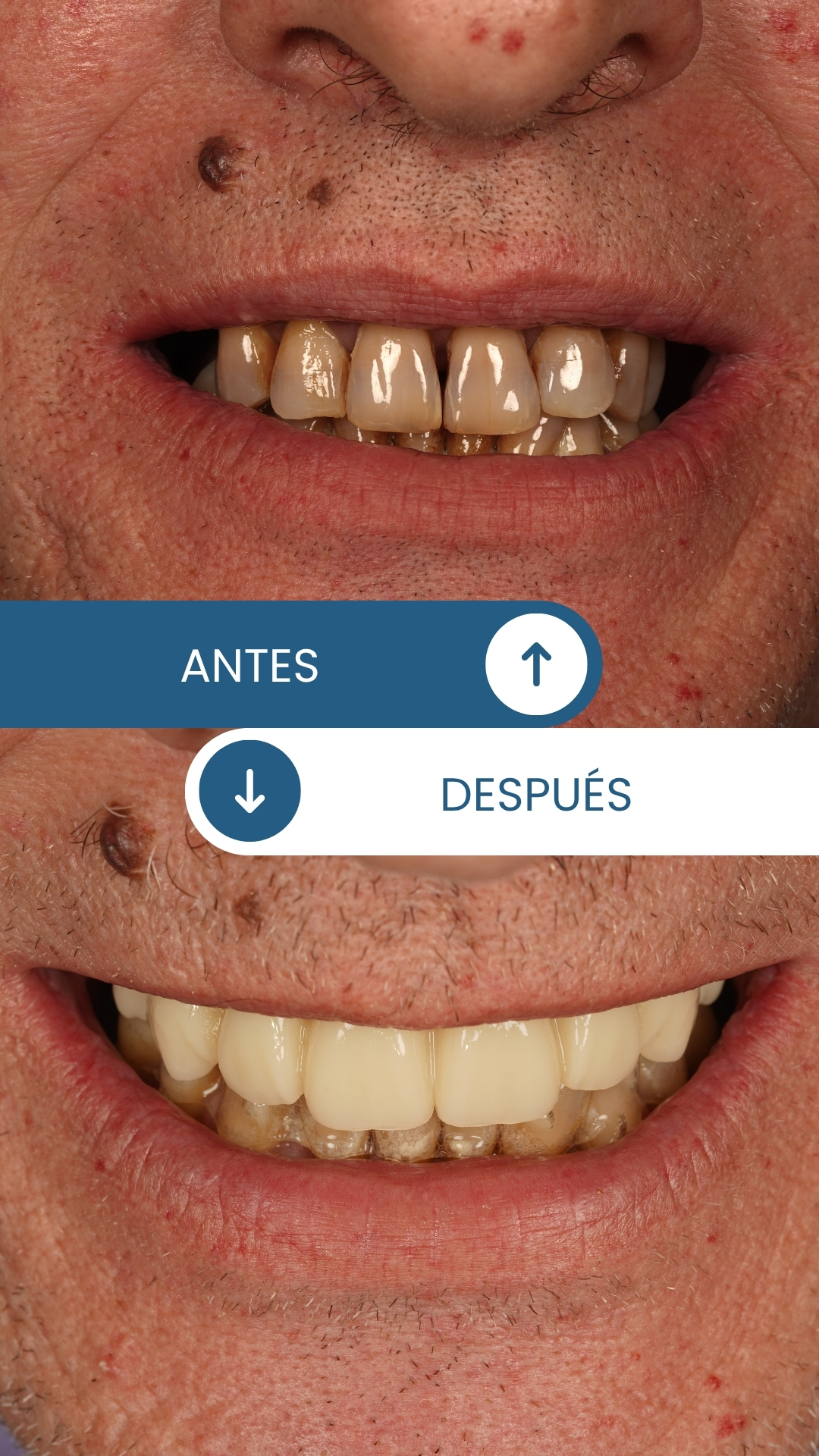 Caso real de rehabilitación oral 2