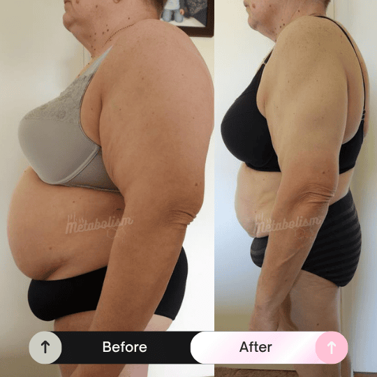 Before and after transformation 7